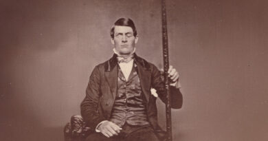 Финеас Гейдж: человек с дырой в голове