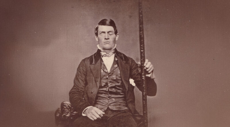 Финеас Гейдж: человек с дырой в голове